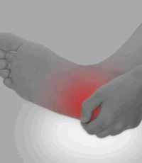 足底筋膜炎の痛み